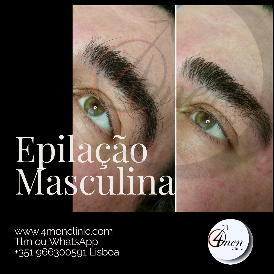 A carregar imagem...