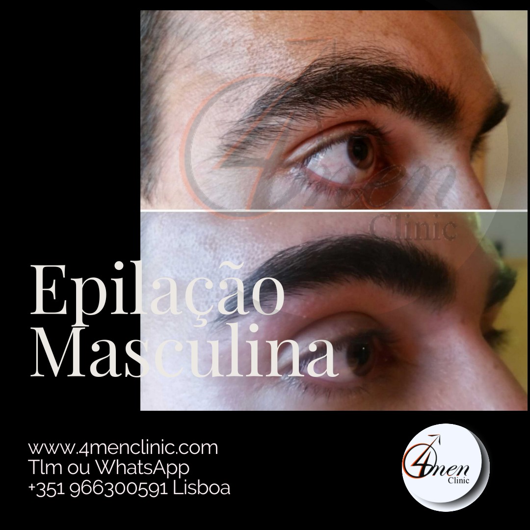 A carregar imagem...