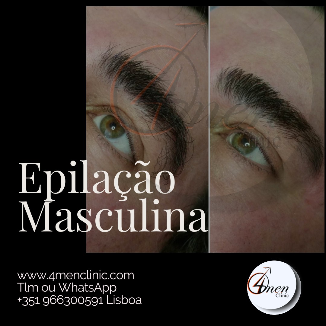 A carregar imagem...