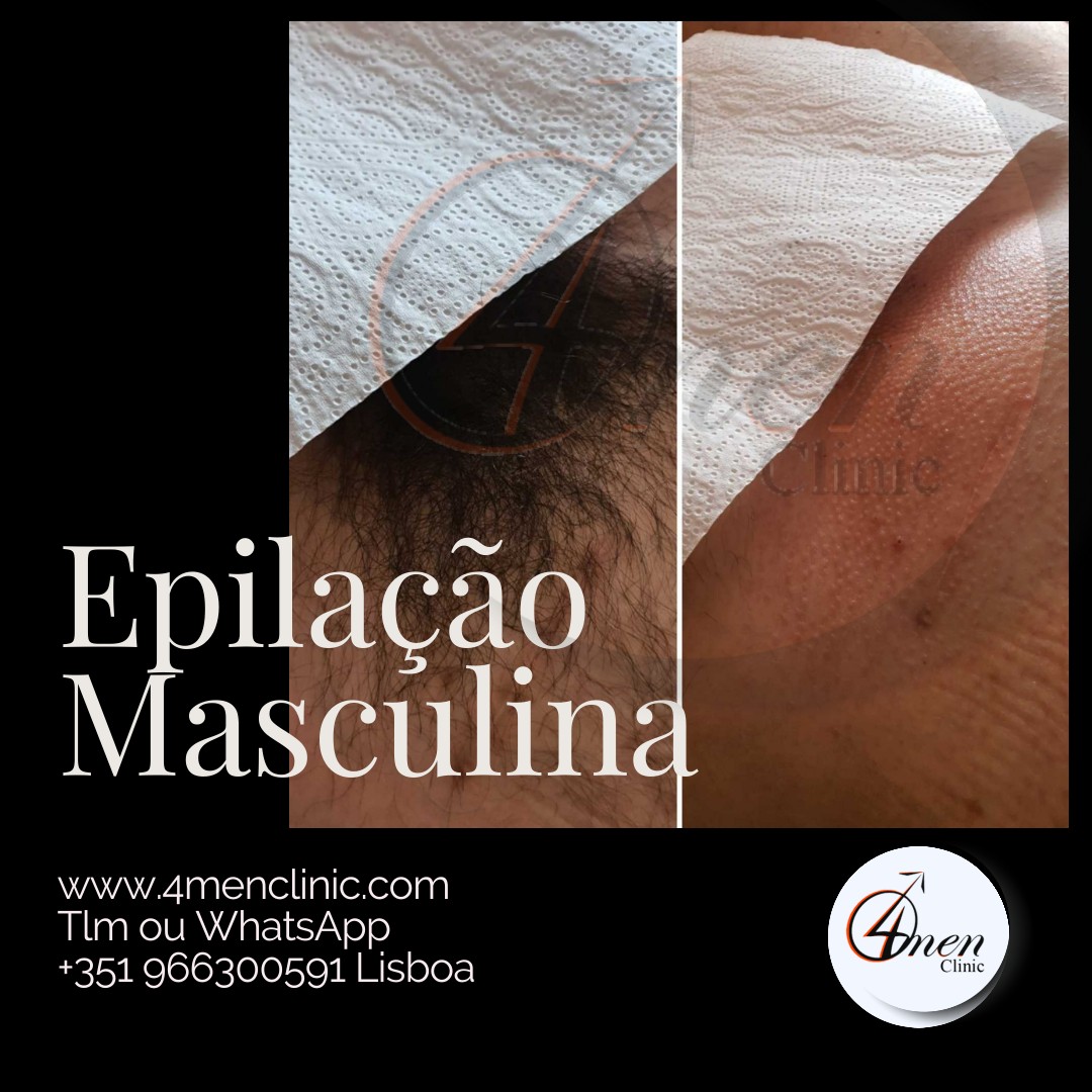 A carregar imagem...