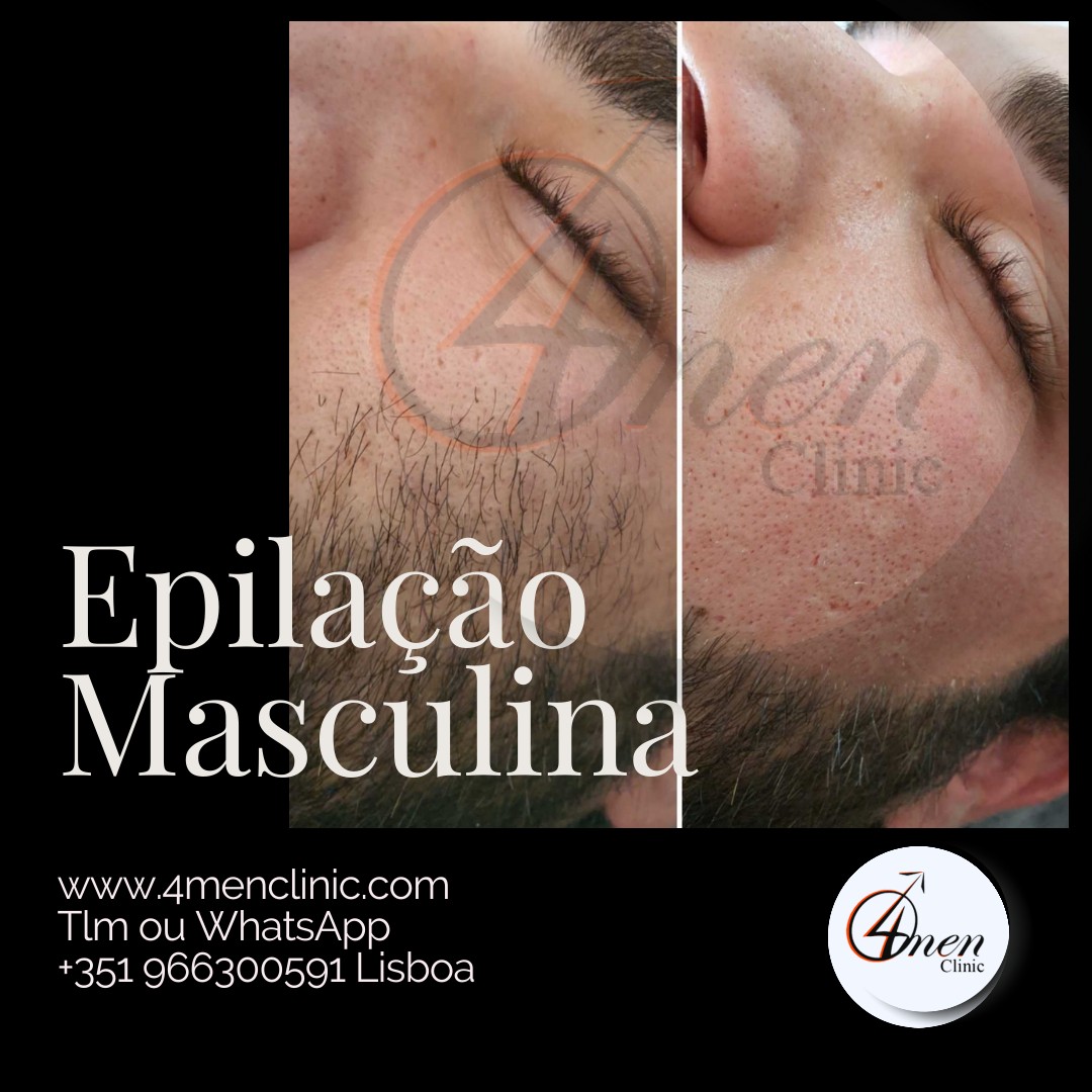 A carregar imagem...