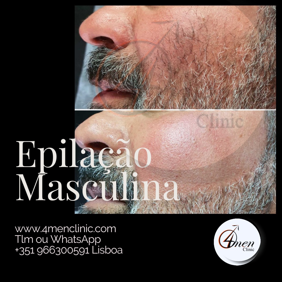 A carregar imagem...