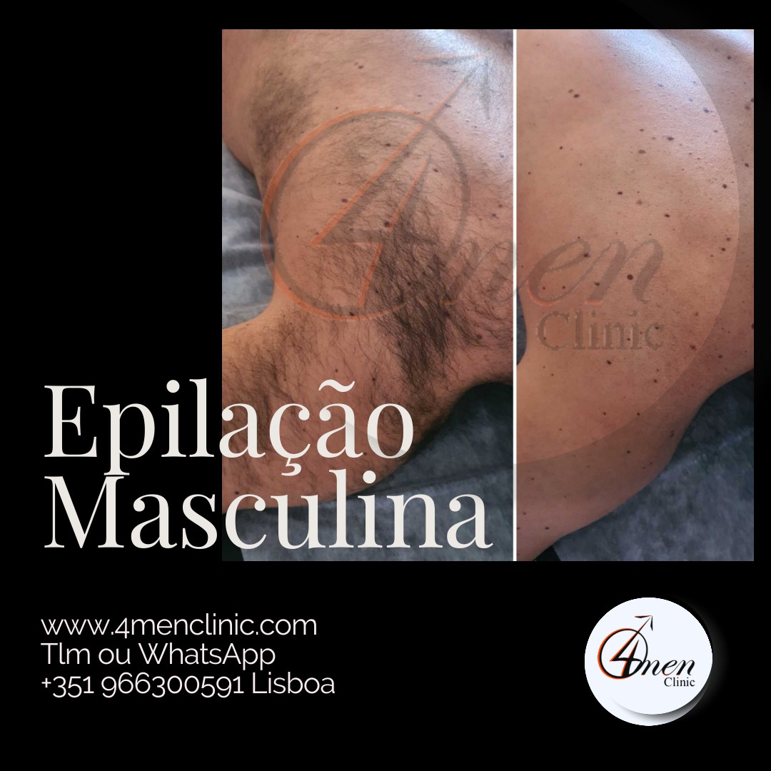 A carregar imagem...