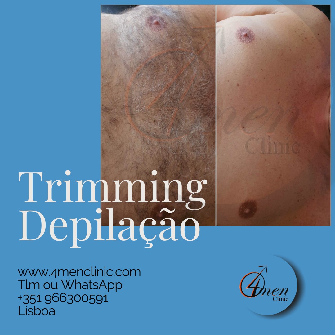 A carregar imagem...