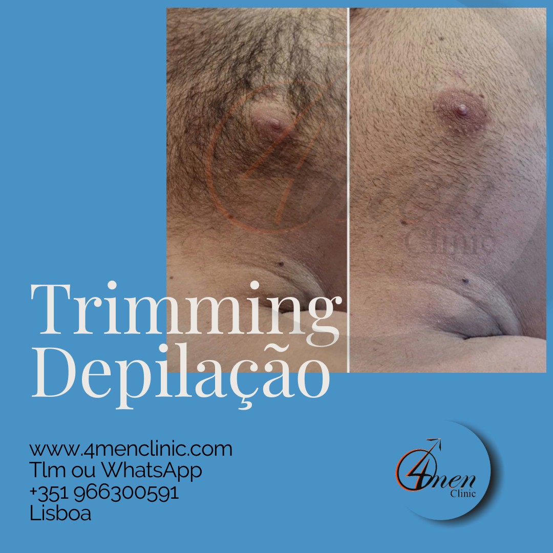 A carregar imagem...